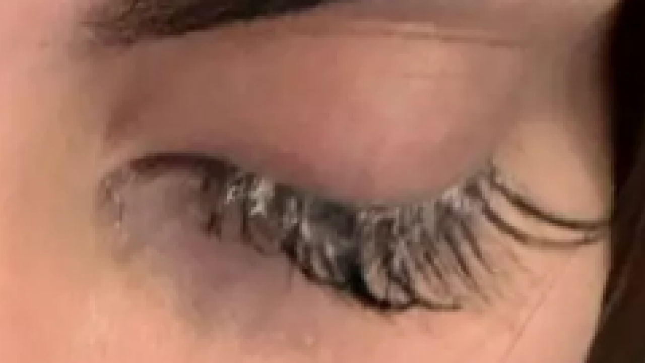 Foto - Korkunç olay: Kirpiklerini yaptırmaya gitti ama gözlerini yaktı... Kör olabilirdim! Görenleri şaşkına çevirdi