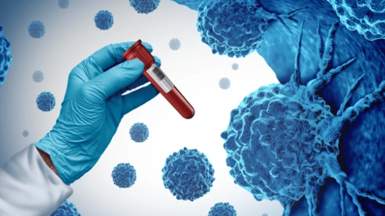 Foto - Korkunç rakamları paylaştılar: İşte Türkiye'deki kanserli sayısı