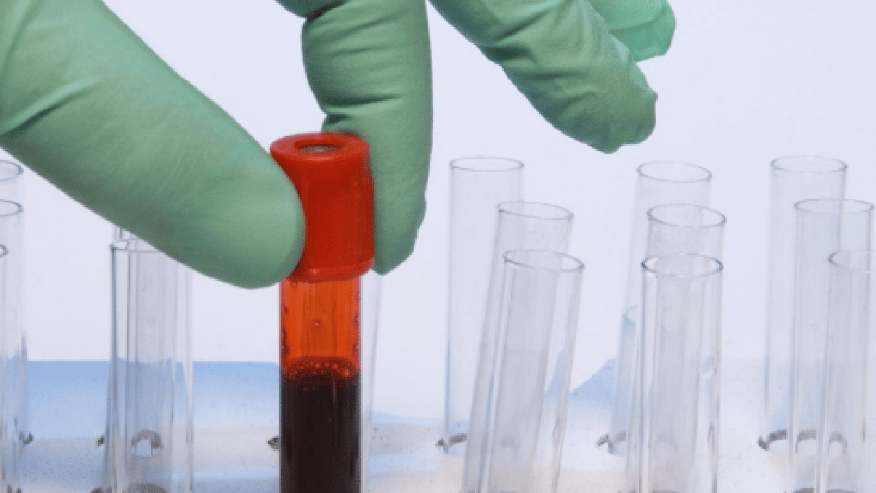 Foto - Korkunç rakamları paylaştılar: İşte Türkiye'deki kanserli sayısı