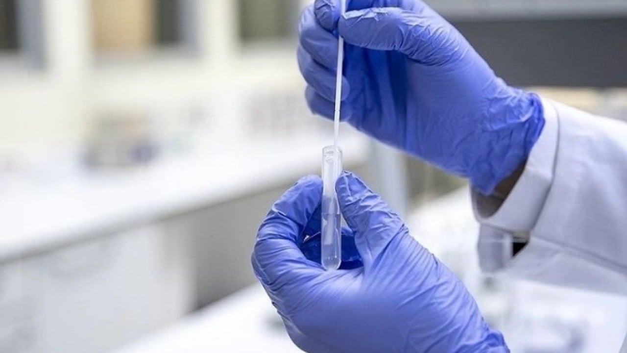 Foto - Koronavirüs vakaları tırmanışta! ‘Frankenstein' varyantı alarm veriyor