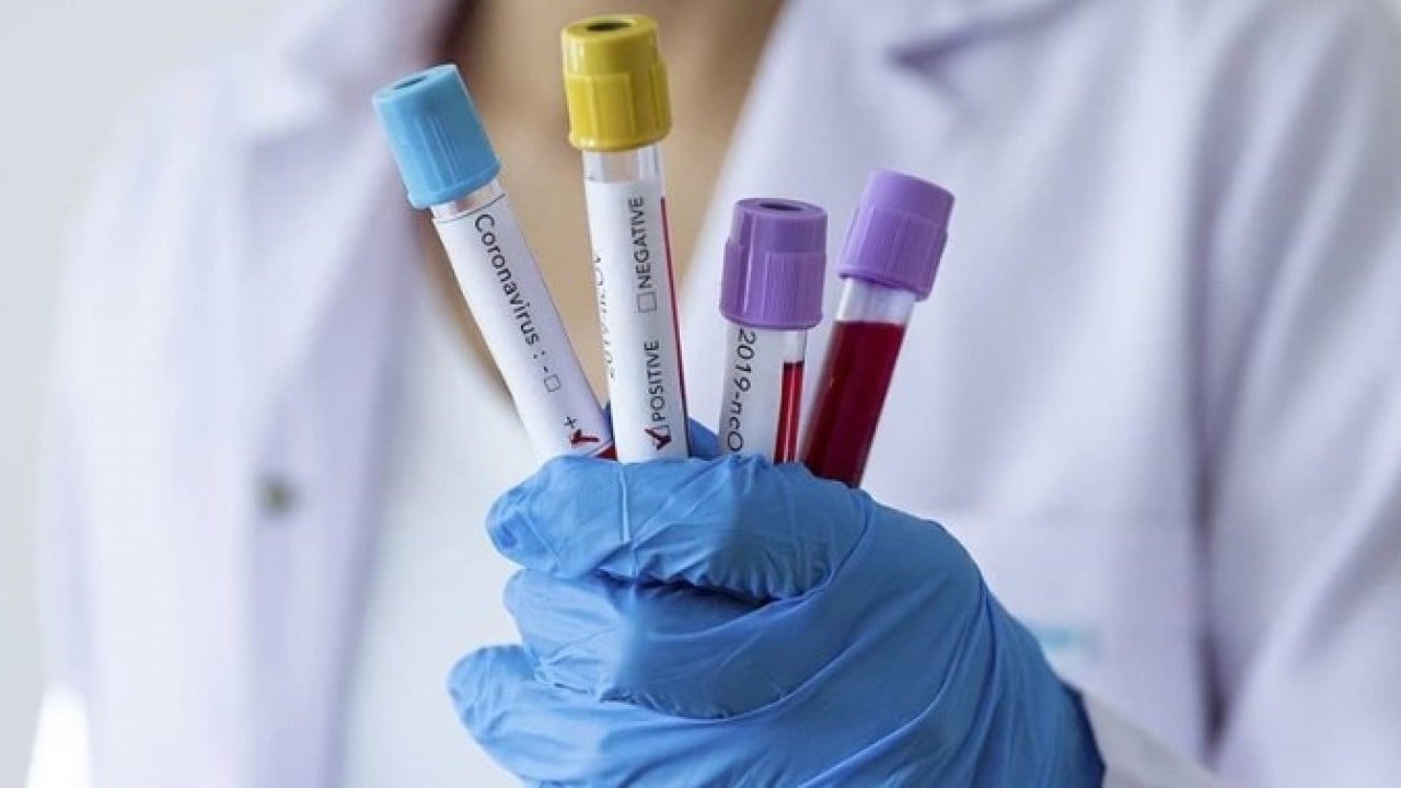 Foto - Koronavirüs vakaları tırmanışta! ‘Frankenstein' varyantı alarm veriyor