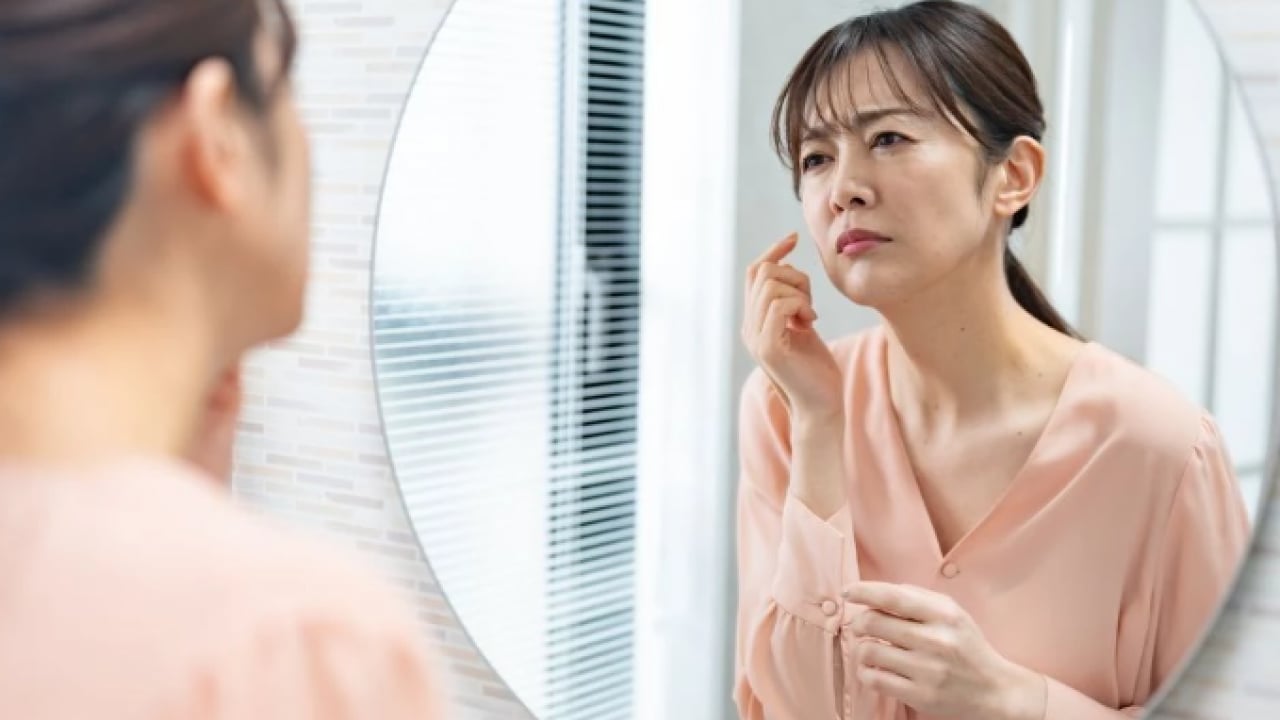 Foto - Kötü görüntü tarihe karışacak! Sivilcelerden kurtulmanın doğal yolu