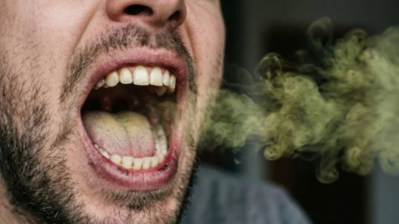 Foto - Kötü nefes kokusunun nedeni belli oldu: İşte 6 ihtimal!