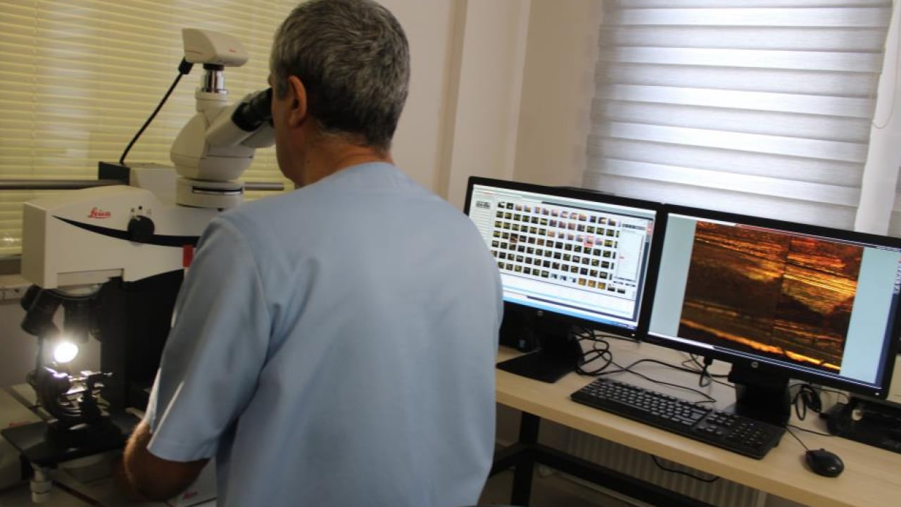 Foto - Kriminal polisler imkansızı başarıyor! Kovanlar eşleşti, oyunlar bozuldu: 280 bin delil karanlığı aydınlattı