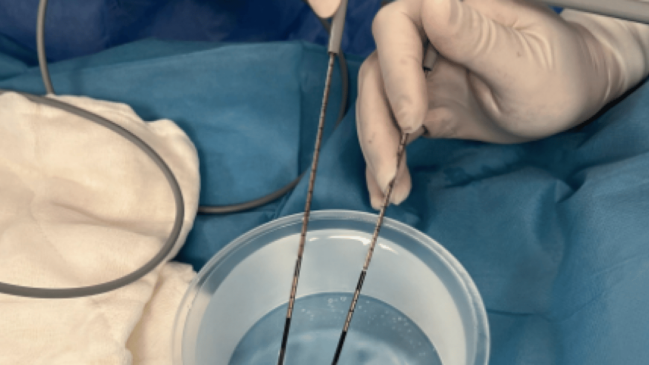 Foto - -20 ile -80 derece arasında değişen bir soğukluk... Kriyoablasyon cerrahiye uygun olmayan...