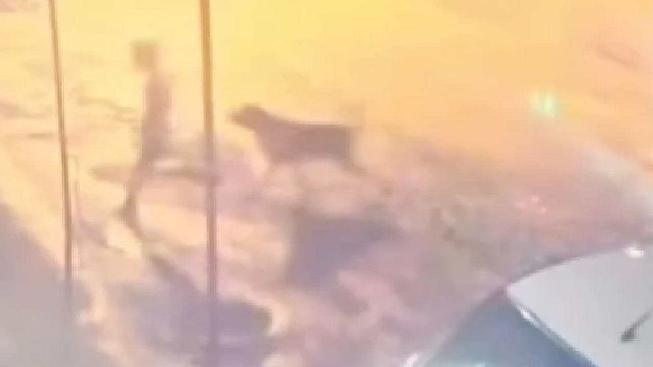 Foto - Küçük çocuğa köpek sürüsü saldırdı! Adıyaman'da kan donduran görüntüler: Bu kaçıncı vaka, bu kaçıncı feryat?