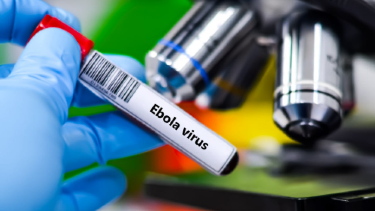 Foto - Küresel sağlıkta Ebola alarmı! ABD duyurdu: Tarihin en ölümcül seviyesine ulaşabilir