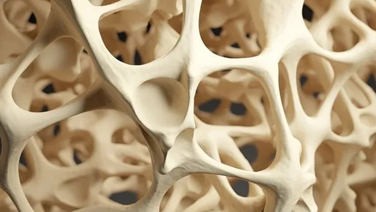 Foto - Kuru erik: İnsülin direncini kırıp bağırsakları çalıştırıyor! Kemikleri betona çeviriyor 