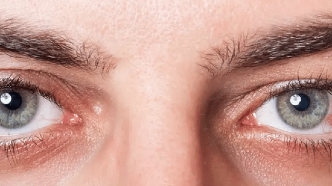 Foto - Lazer ya da cerrahi tedavi... Göz tansiyonunda erken tanı körlüğün önüne geçiyor