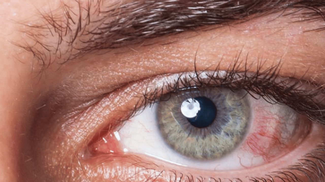 Foto - Lazer ya da cerrahi tedavi... Göz tansiyonunda erken tanı körlüğün önüne geçiyor