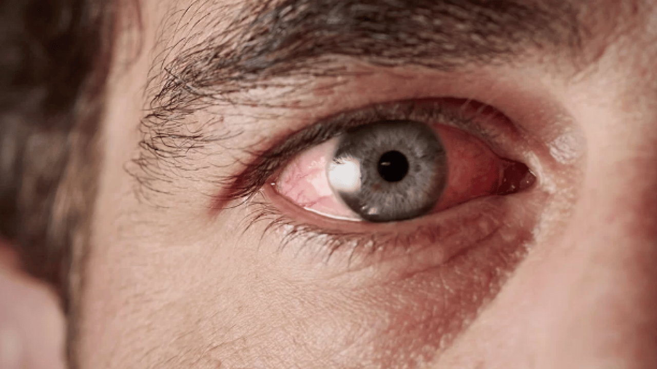 Foto - Lazer ya da cerrahi tedavi... Göz tansiyonunda erken tanı körlüğün önüne geçiyor