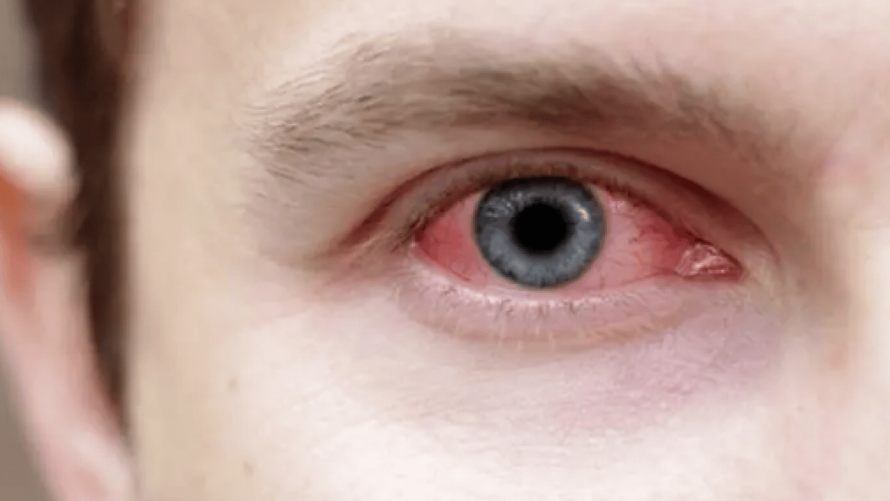 Foto - Lazer ya da cerrahi tedavi... Göz tansiyonunda erken tanı körlüğün önüne geçiyor