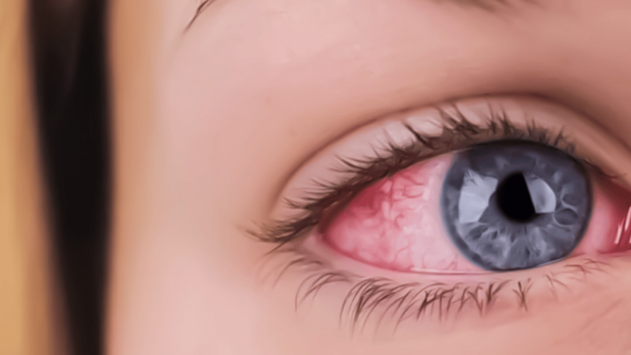 Foto - Lazer ya da cerrahi tedavi... Göz tansiyonunda erken tanı körlüğün önüne geçiyor