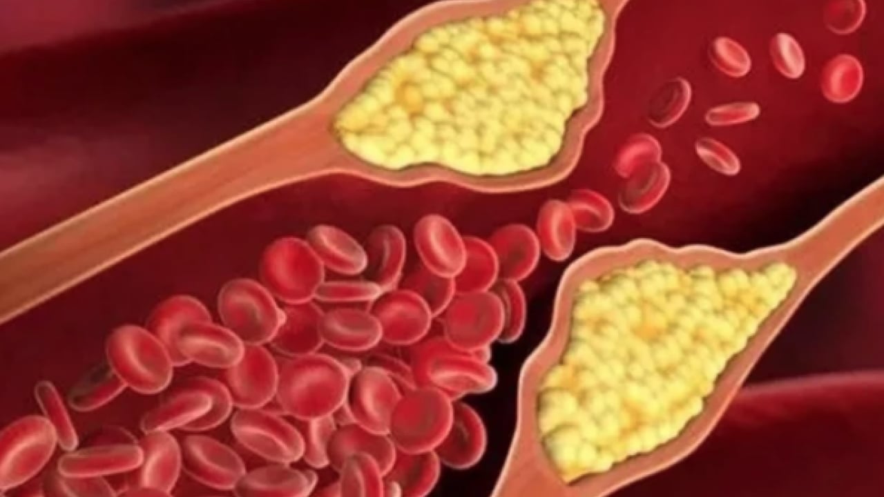 LDL, mg/dL'nin altına... Kolesterolde 'İyi-kötü' devri kapandı: Yeni nesil kılavuz açıklandı