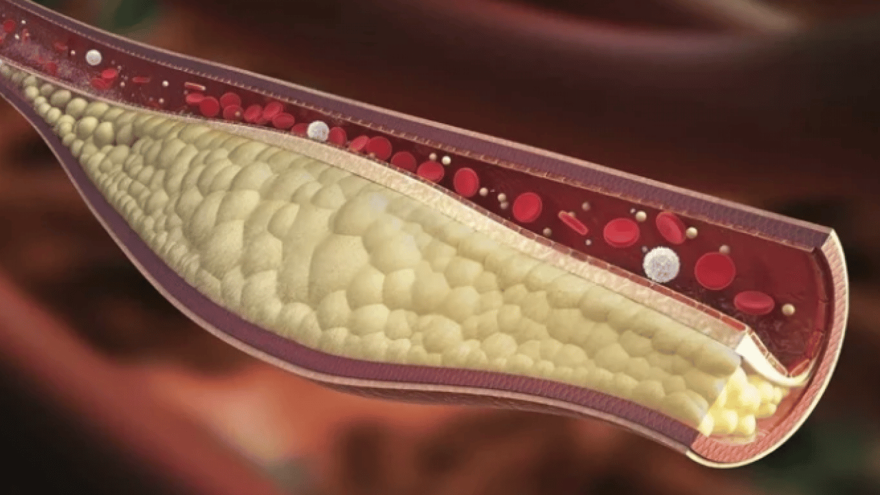 Foto - LDL, mg/dL'nin altına... Kolesterolde 'İyi-kötü' devri kapandı: Yeni nesil kılavuz açıklandı