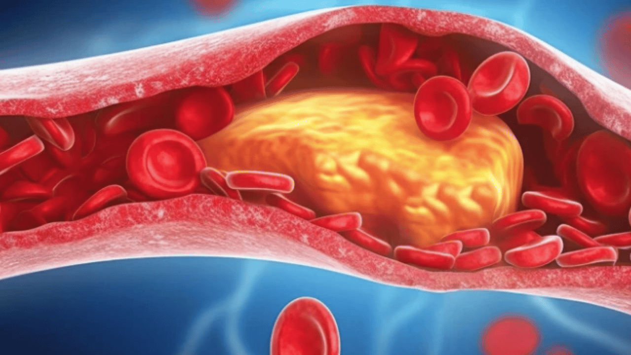 Foto - LDL, mg/dL'nin altına... Kolesterolde 'İyi-kötü' devri kapandı: Yeni nesil kılavuz açıklandı