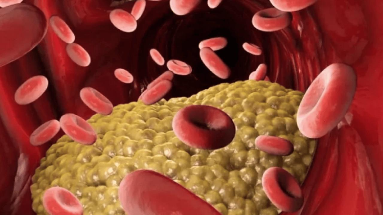 Foto - LDL, mg/dL'nin altına... Kolesterolde 'İyi-kötü' devri kapandı: Yeni nesil kılavuz açıklandı