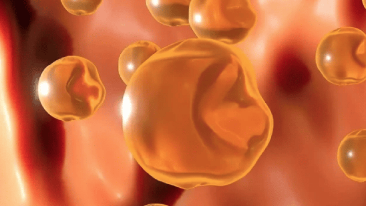 Foto - LDL, mg/dL'nin altına... Kolesterolde 'İyi-kötü' devri kapandı: Yeni nesil kılavuz açıklandı