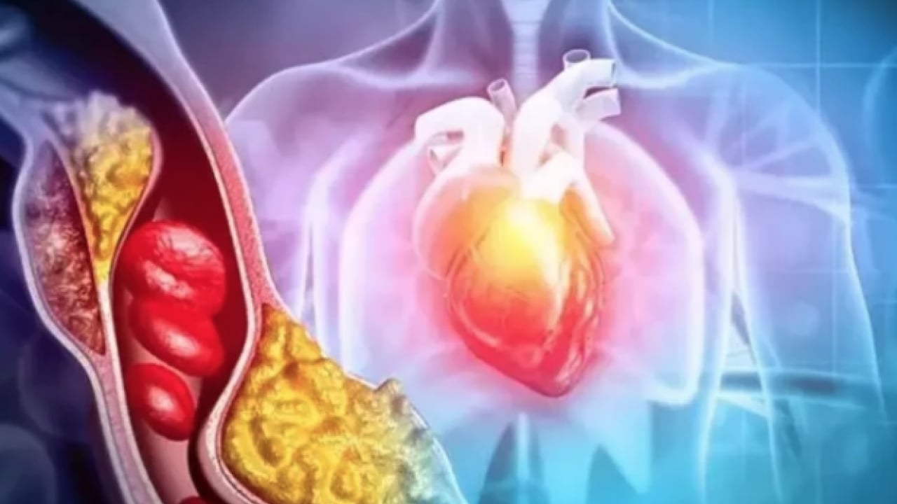 Foto - LDL, mg/dL'nin altına... Kolesterolde 'İyi-kötü' devri kapandı: Yeni nesil kılavuz açıklandı