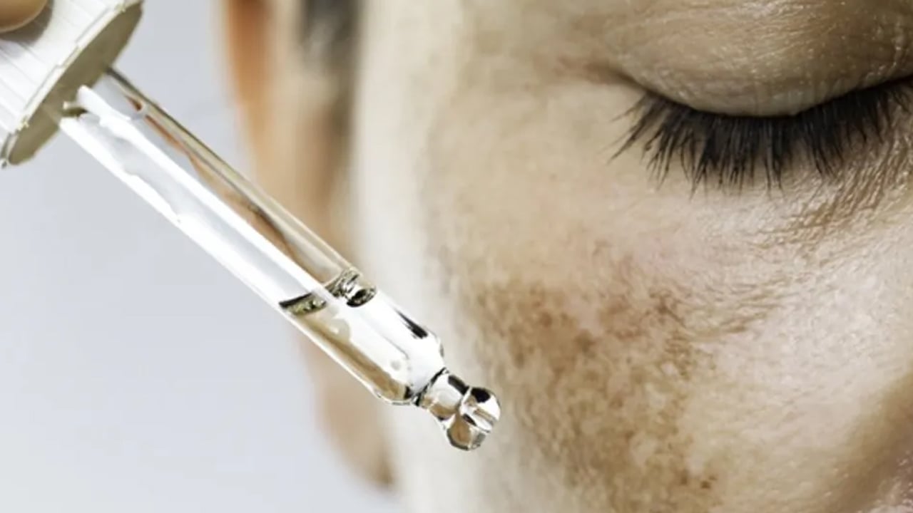 Foto - Leke silme formülü: Ciltten lekeler nasıl çıkarılır?