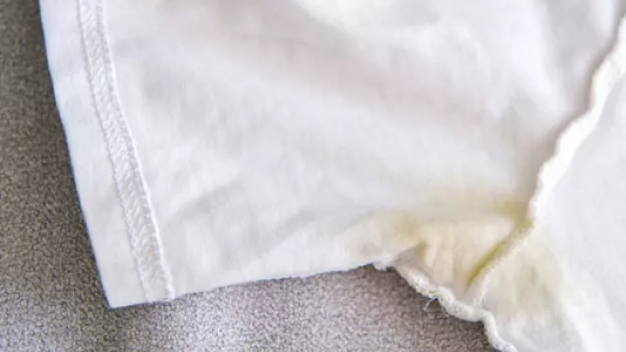 Foto - Limon meğer ne kadar faydalıymış! Sararan beyazlara gelen çözüm...