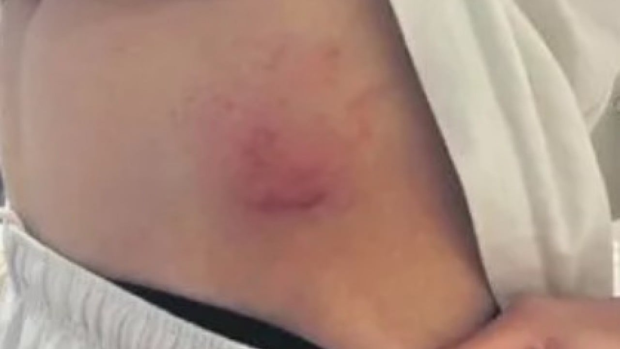 Foto - Lise mi toplama kampı mı? ‘Disiplin edeceğiz’ diye çocukları ne hale getirdiler! 