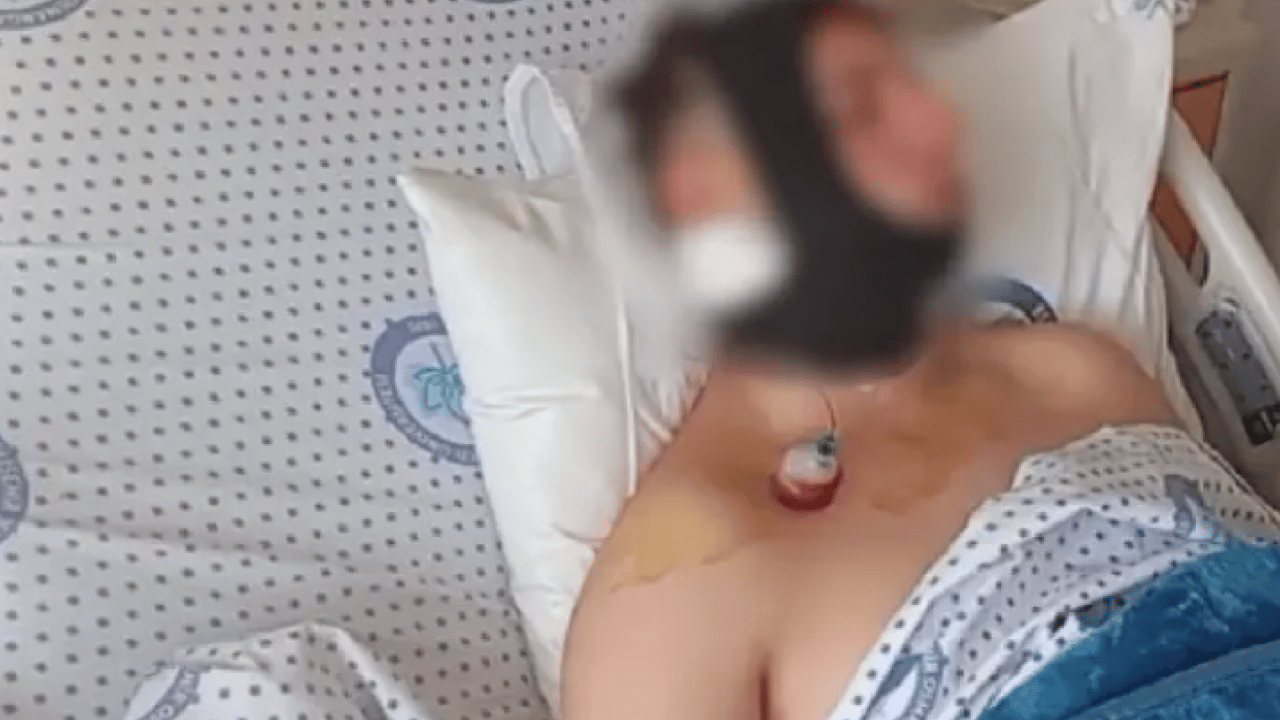 Foto - Lisede akran zorbalığı! Sırasına oturan arkadaşının çenesini kırdı