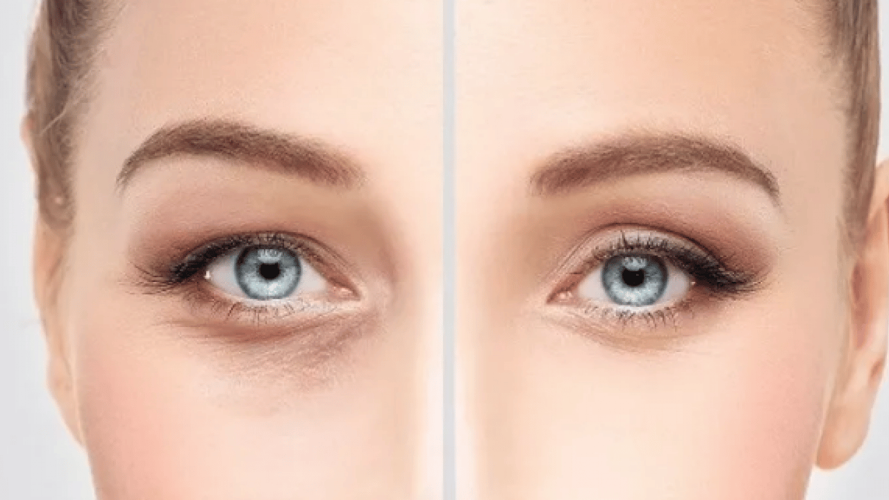 Makyajsız aydınlık göz çevresi: 3 sabah rutini ile cildin doğal nem dengesini korumanın doğal yolları bulundu!