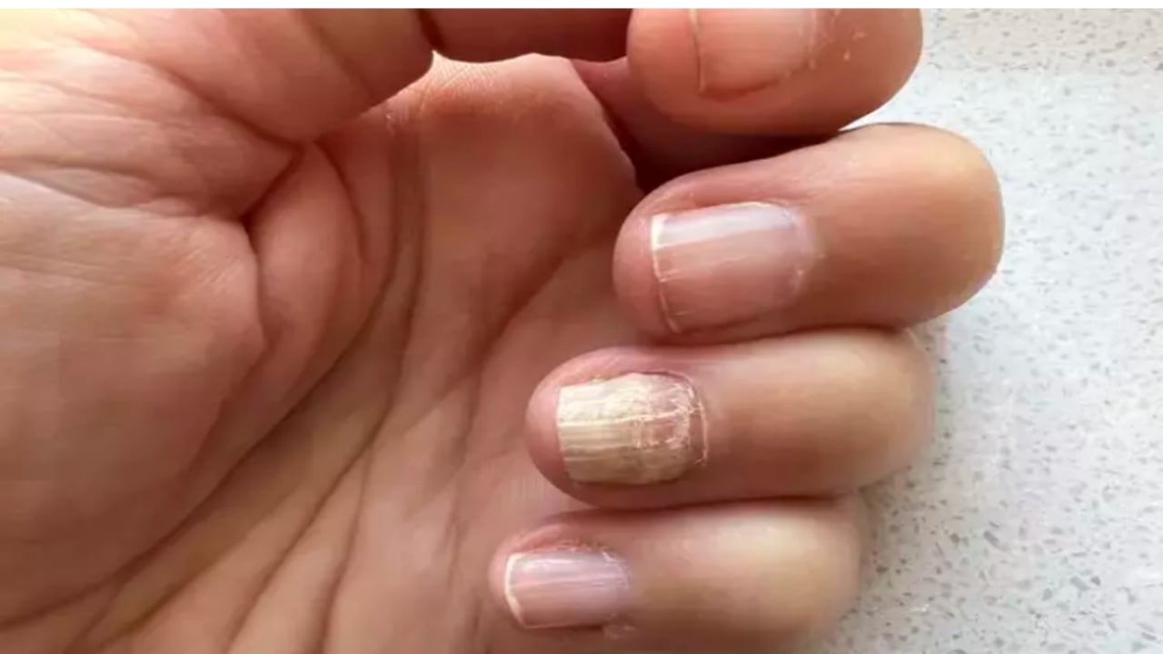 Foto - Meğer çözümü kimse bilmiyormuş! İşte tırnak mantarını tek gecede kurutan, ayak kokusunu vakum gibi çeken mucizevi yöntem