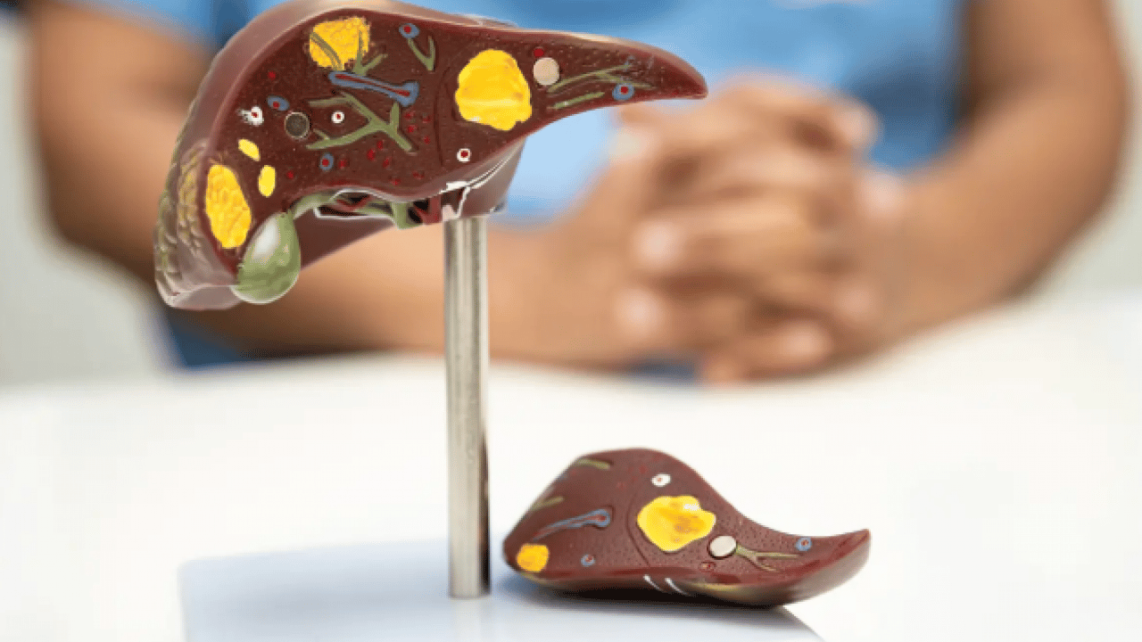 Foto - Meğer karaciğeri mahvediyormuş! Sofranızdan kaldırmanız gereken 3 besin!