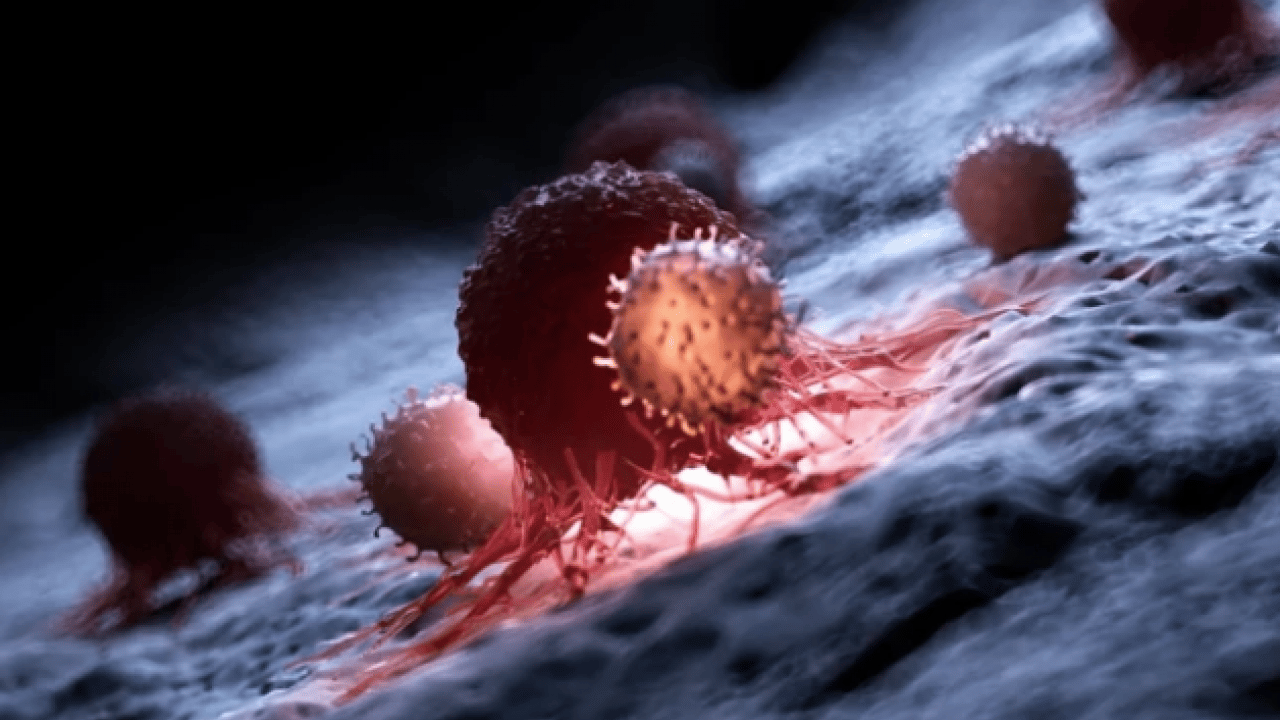 Foto - Melanom hastalarının... Bağırsak bakterilerinin kanser ile ilişkisi ortaya çıktı