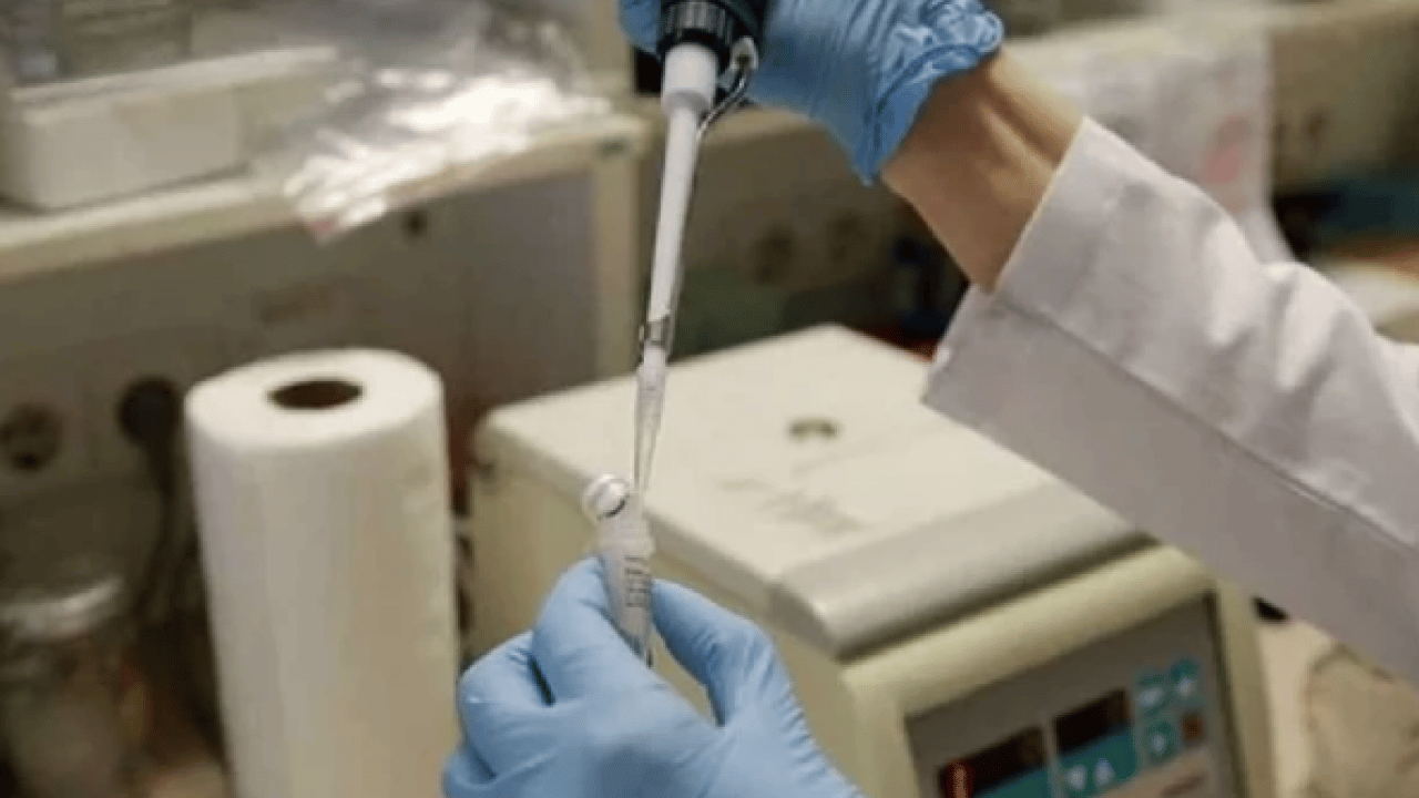 Foto - Melanom hastalarının... Bağırsak bakterilerinin kanser ile ilişkisi ortaya çıktı