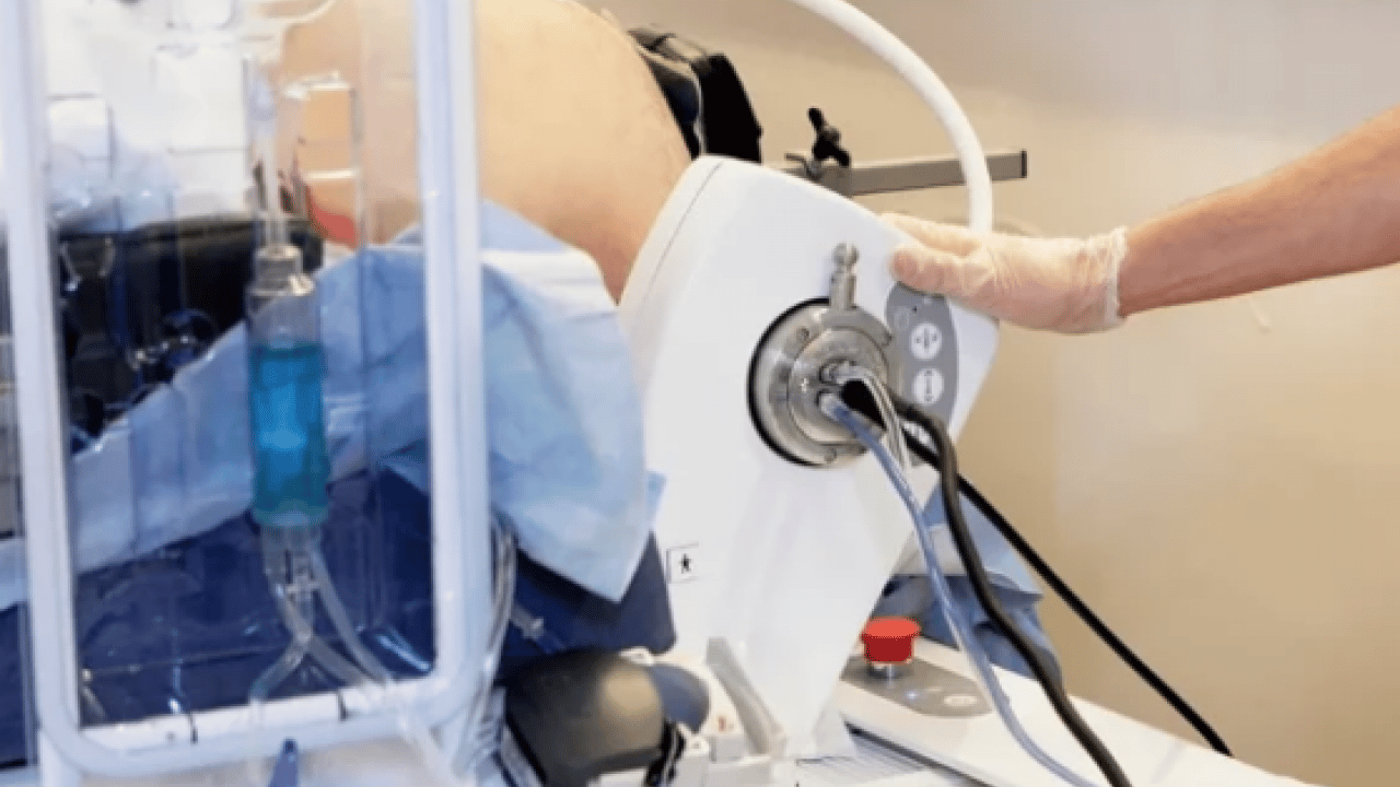 Foto - Melanom hastalarının... Bağırsak bakterilerinin kanser ile ilişkisi ortaya çıktı