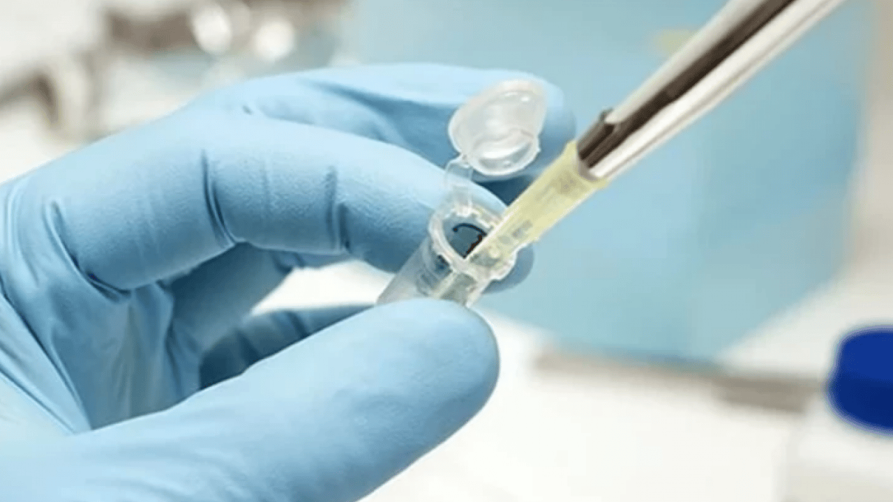 Foto - Melanom hastalarının... Bağırsak bakterilerinin kanser ile ilişkisi ortaya çıktı