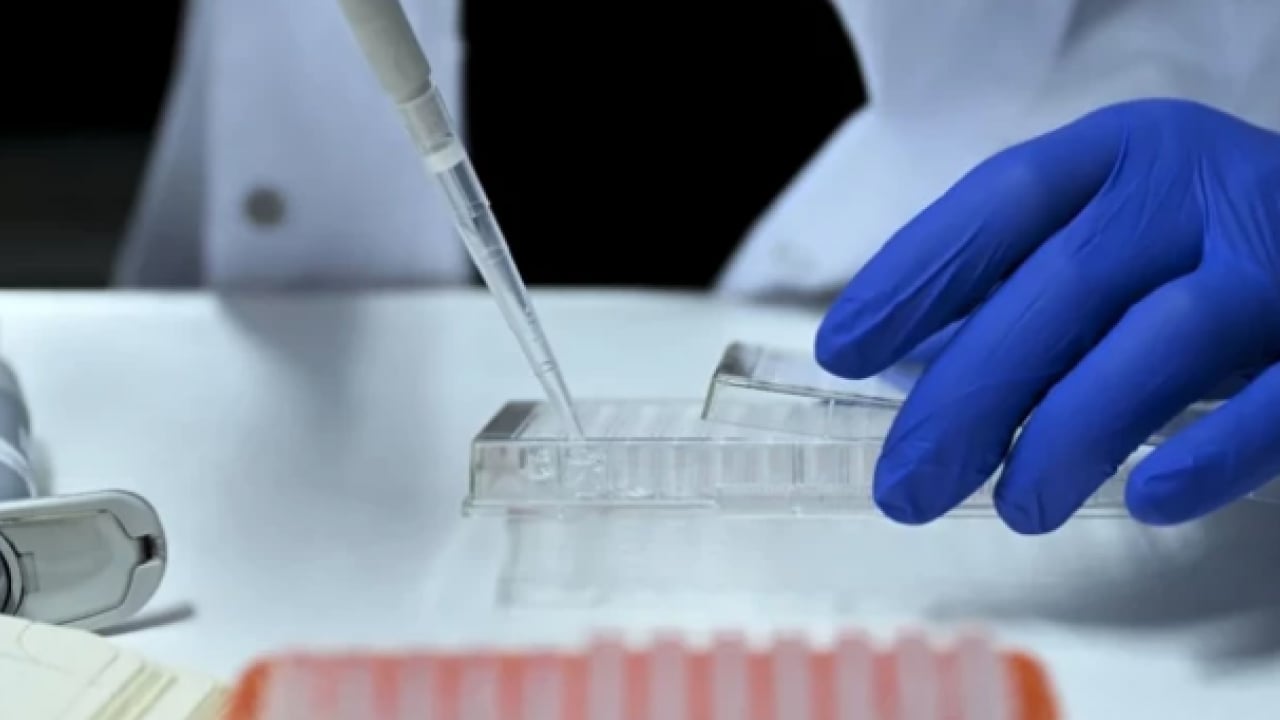 Foto - Melanom hastalarının... Bağırsak bakterilerinin kanser ile ilişkisi ortaya çıktı