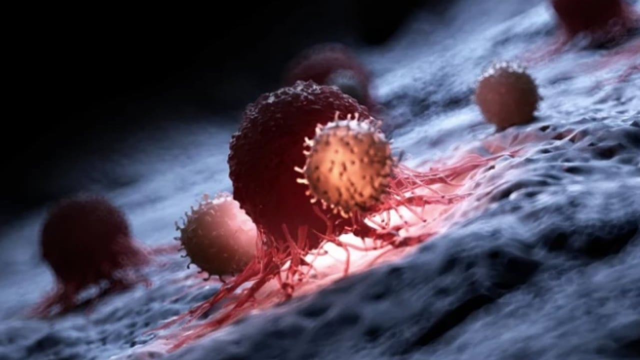 Foto - Melanom hastalarının... Bağırsak bakterilerinin kanser ile ilişkisi ortaya çıktı