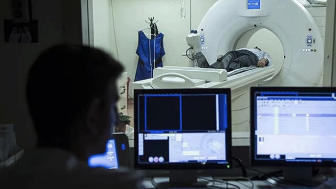 Foto - Melanom hastalarının... Bağırsak bakterilerinin kanser ile ilişkisi ortaya çıktı