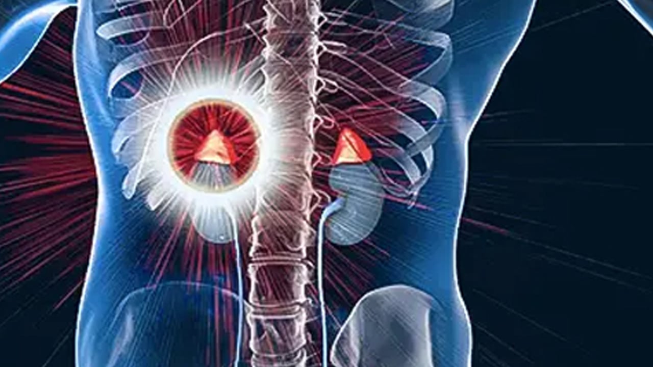 Foto - Melih Kara: Böbrek üstüne ait bezde tehlike olabilir! Mide bulantısı gibi çok sayıda belirti var diyerek duyurdu