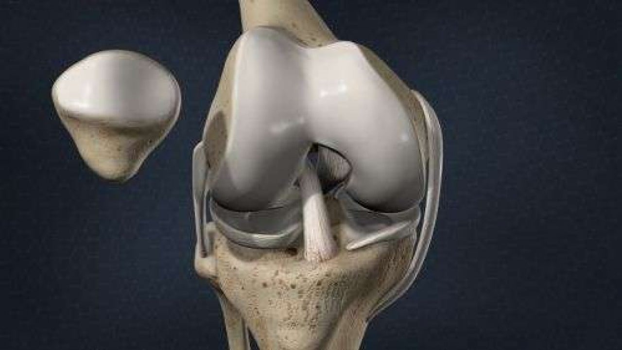 Foto - Menisküs yırtıldığında mutlaka ameliyat olunmalı mı? Uzmanlardan uyarı geldi!