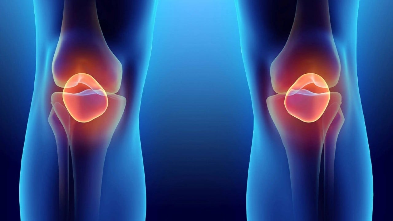 Foto - Menisküs yırtıldığında mutlaka ameliyat olunmalı mı? Uzmanlardan uyarı geldi!