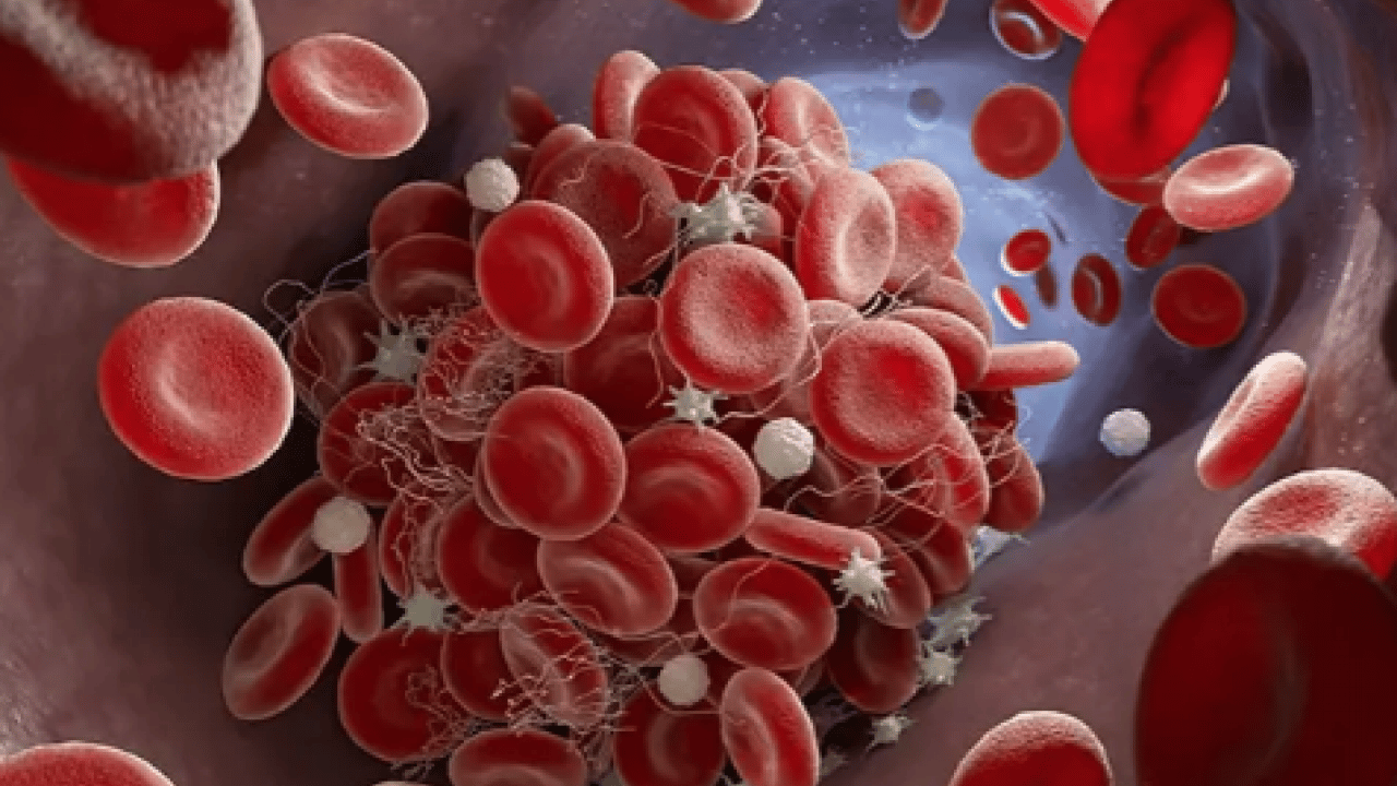 Foto - Yüksek kolesterol değerlerini kısa sürede düzeltiyor! Meyve ve sebzeler: Kolesterole karşı daha sağlıklı