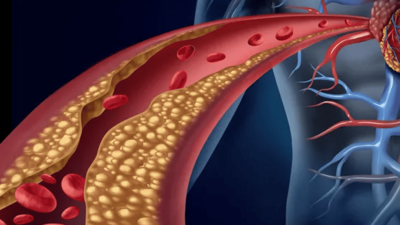 Foto - Yüksek kolesterol değerlerini kısa sürede düzeltiyor! Meyve ve sebzeler: Kolesterole karşı daha sağlıklı