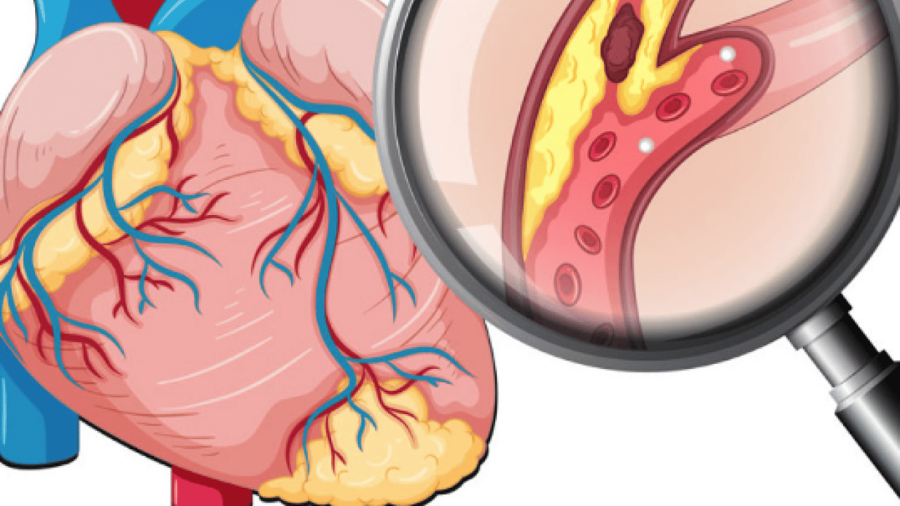 Foto - Yüksek kolesterol değerlerini kısa sürede düzeltiyor! Meyve ve sebzeler: Kolesterole karşı daha sağlıklı
