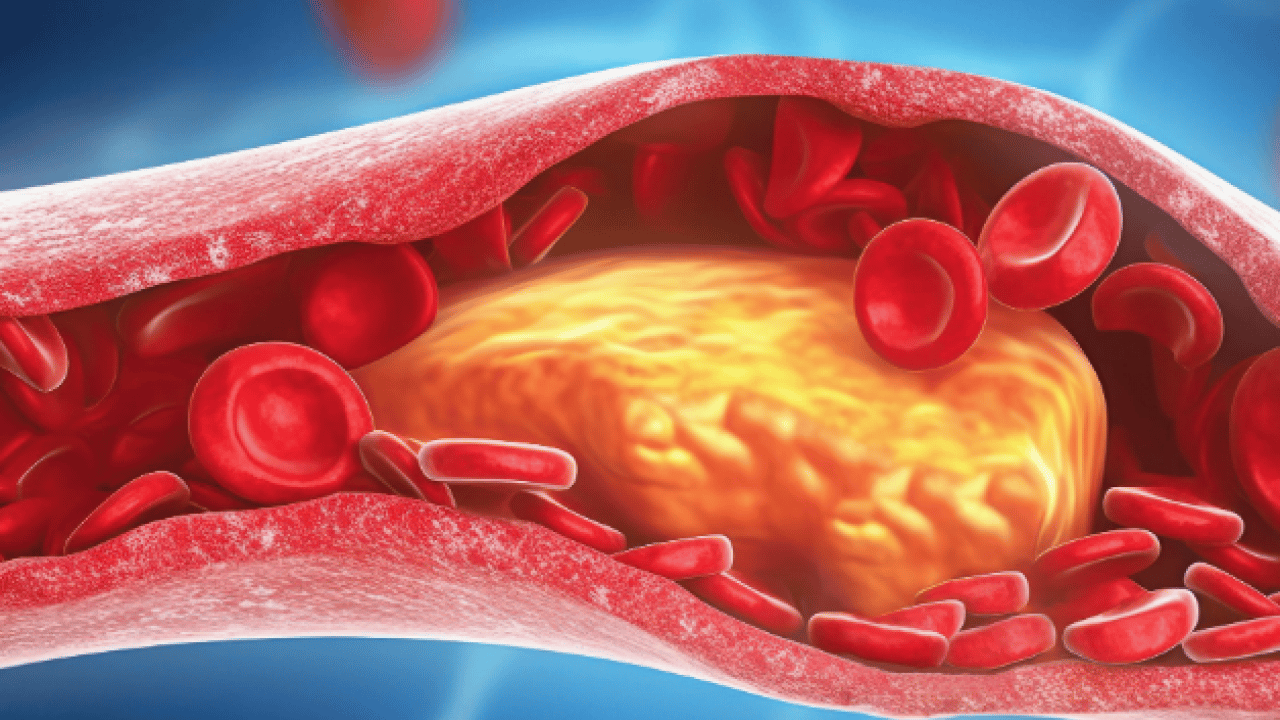Foto - Yüksek kolesterol değerlerini kısa sürede düzeltiyor! Meyve ve sebzeler: Kolesterole karşı daha sağlıklı