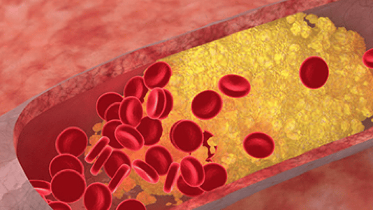 Foto - Yüksek kolesterol değerlerini kısa sürede düzeltiyor! Meyve ve sebzeler: Kolesterole karşı daha sağlıklı