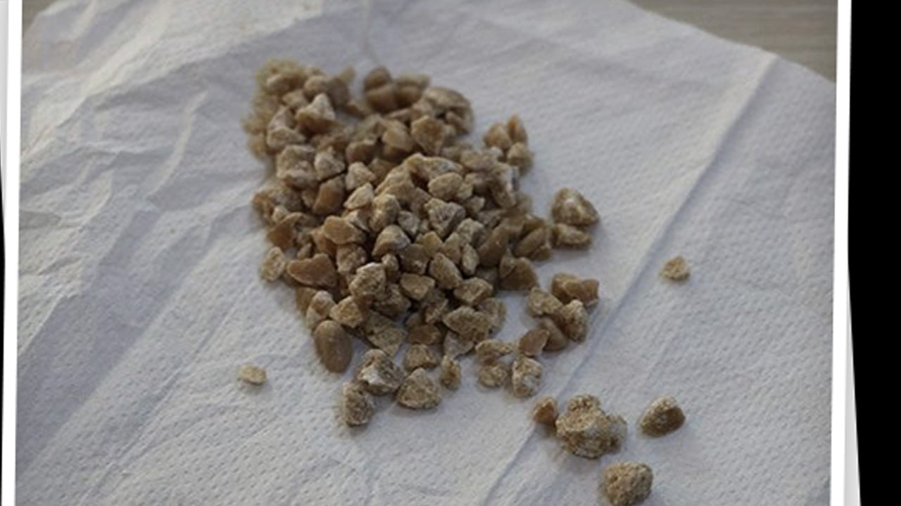 Foto - Mide hassasiyeti ve böbrek taşı olanlar dikkat: Kuzu kulağı şifa değil zehir saçıyor! Böyle yapan pişman olacak! 