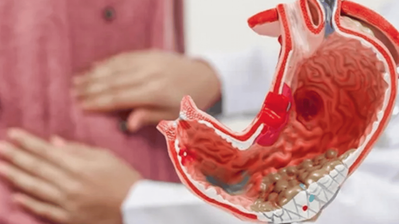 Foto - Mide kanamalarında olmazsa olmaz erken müdahale hayat kurtarıyor: Vazgeçilmez aracı! Uzmandan şok uyarı mesajı