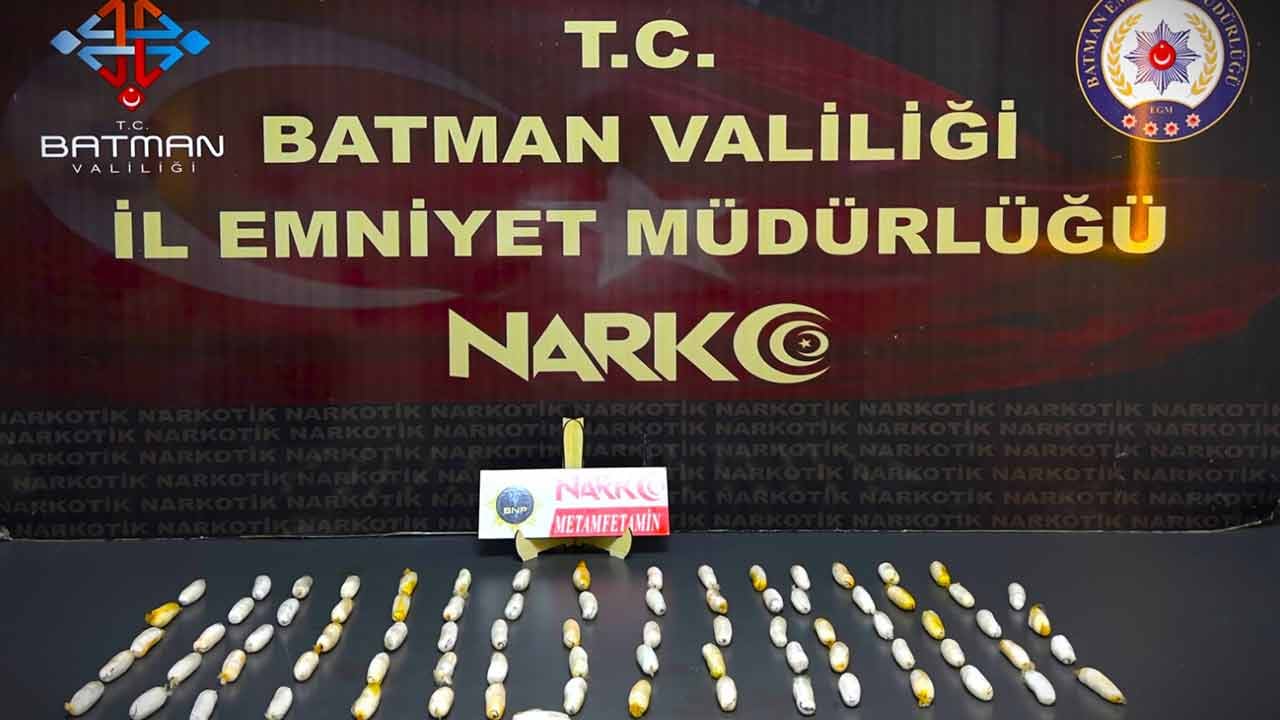 Foto - Midelerinden çıkanlar şoka soktu! Tam 353 parça....