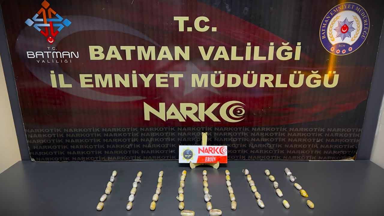Foto - Midelerinden çıkanlar şoka soktu! Tam 353 parça....