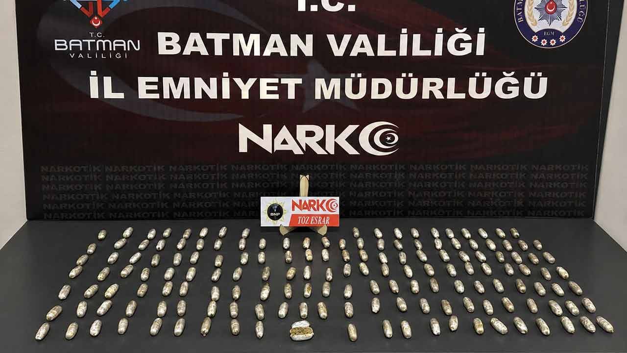 Foto - Midelerinden çıkanlar şoka soktu! Tam 353 parça....